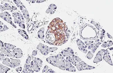 Anti-Chromogranin C antibody [HL2992] used in IHC (Paraffin sections) (IHC-P). GTX640402